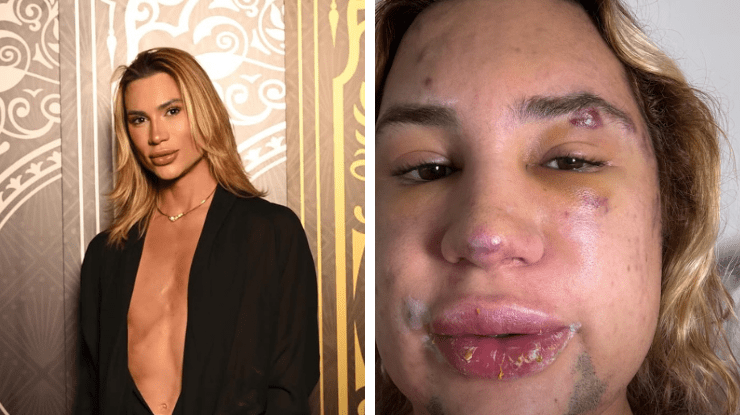 quem-foi-junior-dutra,-influenciador-que-morreu-apos-procedimento-estetico-|-cnn-brasil