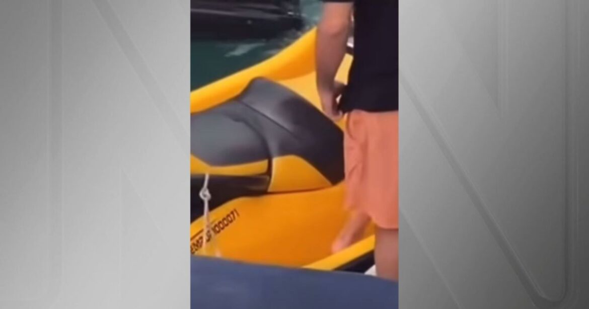 mulher-tem-cabelo-sugado-por-moto-aquatica-e-sofre-corte-de-18-centimetros-|-cnn-brasil